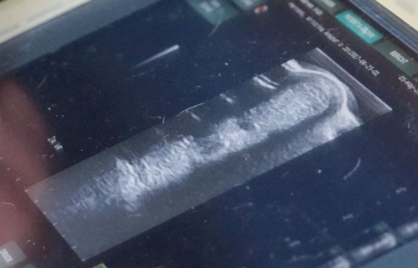 Ultraschallbild einer Pferdesehne auf dem Monitor mit deutlich erkennbarem Sehnenquerschnitt zur Beurteilung eines Sehnenschadens.