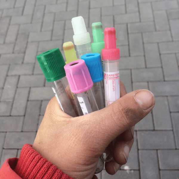 Hand hält mehrere bunte Blutröhrchen, die Blutuntersuchung ist zentral bei der Abklärung von Stoffwechselerkrankungen