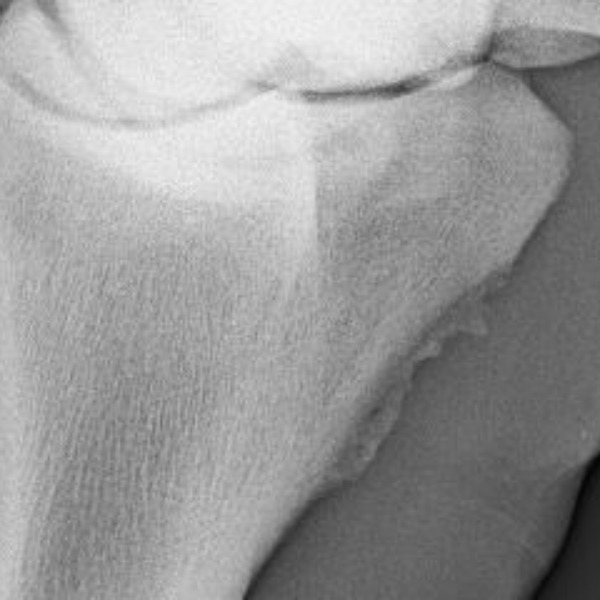 Röntgenbild eines Pferdegelenks mit knöchernen Zubildungen am Gelenkrand, wie sie bei Arthrose entstehen